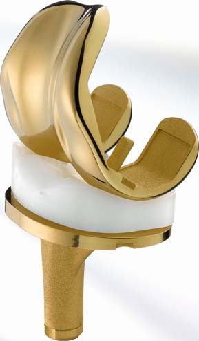 B Braun AS Emotion Total Knee Replacement showing Gold ceramic coating of Zirconium Nitride